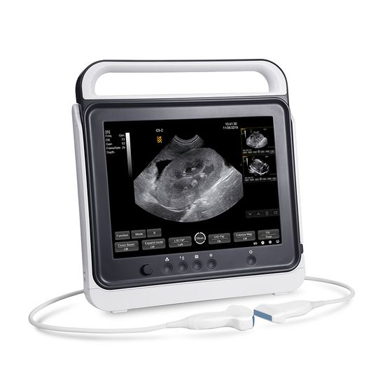 My-A012-N Medical Device Vet B/W Ultrasound Scanner System Portable Veterinary Ultrasound Machine with Micro Convex Probe pictures & photos