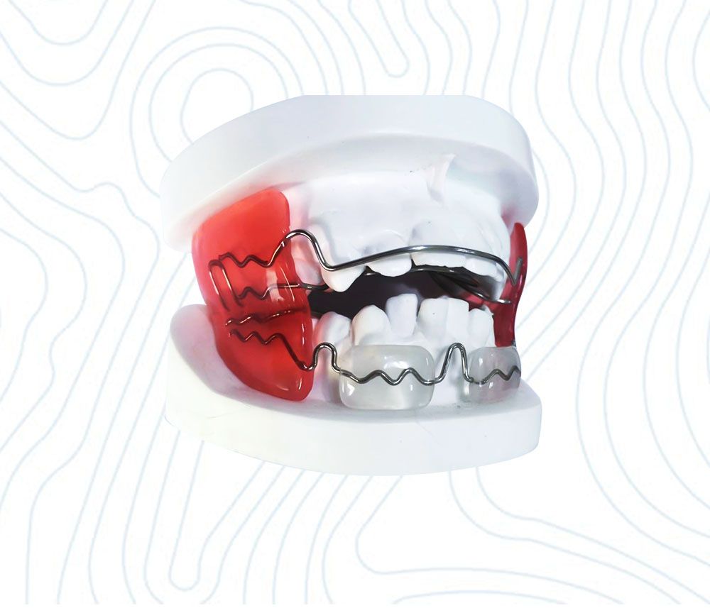 Dental Nance Orthodontics From China Dental Lab